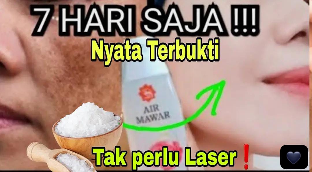 3 Cara Pakai Garam untuk Mengelupas Flek Hitam Dalam 1 Malam, Ini Cara Pakainya Agar Wajah Glowing