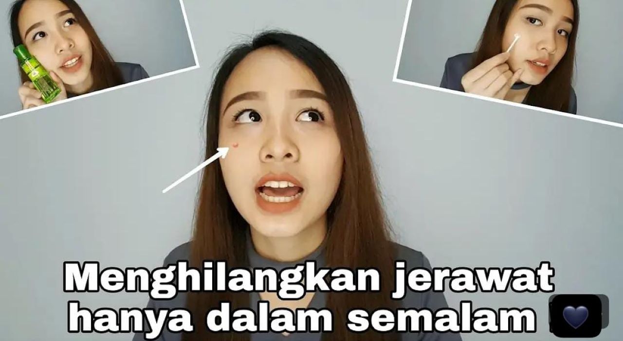 4 Cara Mengatasi Jerawat Pakai Bahan Alami di Dapur Tanpa Ribet