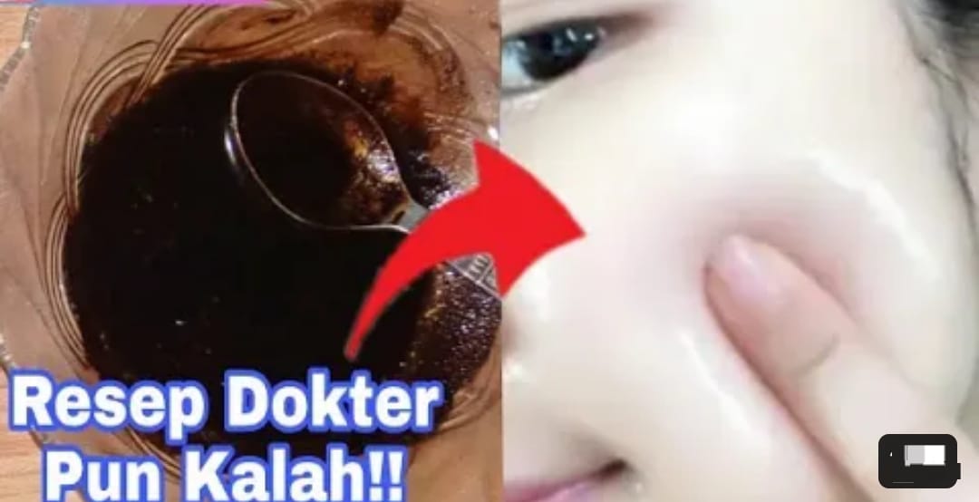 4 Cara Memutihkan Wajah Secara Alami Tanpa Skincare Dengan Cepat, Bantu Basmi Noda Hitam dan Kerutan di Wajah