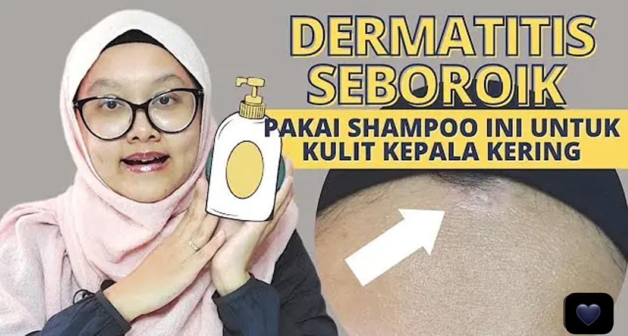 4 Rekomendasi Pilihan Shampo untuk Rambut Kering dan Rusak Terbaik, Modal 15 Ribu Ada di Indomaret