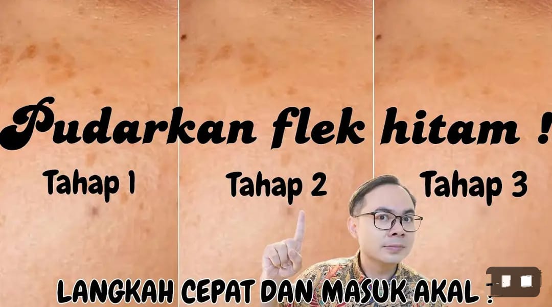 4 Masker Muka Bahan Dapur Penghilang Flek Hitam di Wajah Dalam 1 Malam, Wajah Langsung Glowing Awet Muda