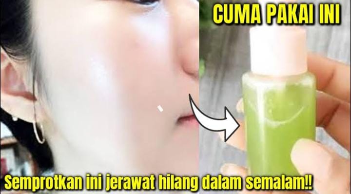 Flek Hitam dan Jerawat Pudar, Begini Cara Membuat Toner Jeruk Nipis dengan Tambahan Air Saja!