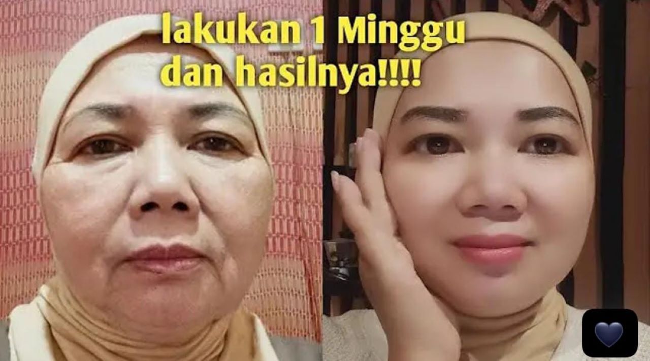 5 Cara Mengencangkan Kulit Kendur dengan Baby Oil, Bantu Samarkan Flek Hitam Dalam 1 Malam