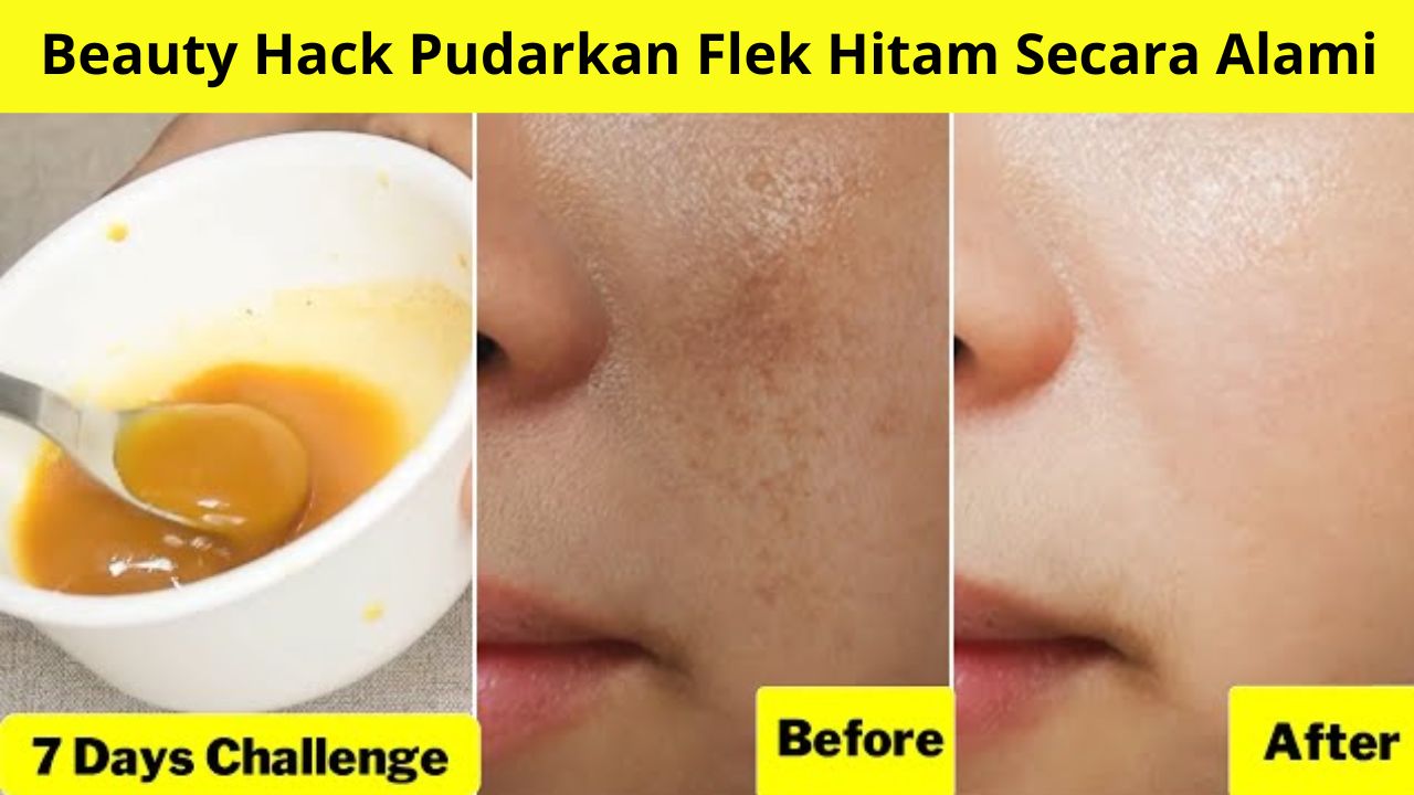 Beauty Hack Pudarkan Flek Hitam Secara Alami, Mengelupas Cuma Pakai 2 Bahan Dapur Ini