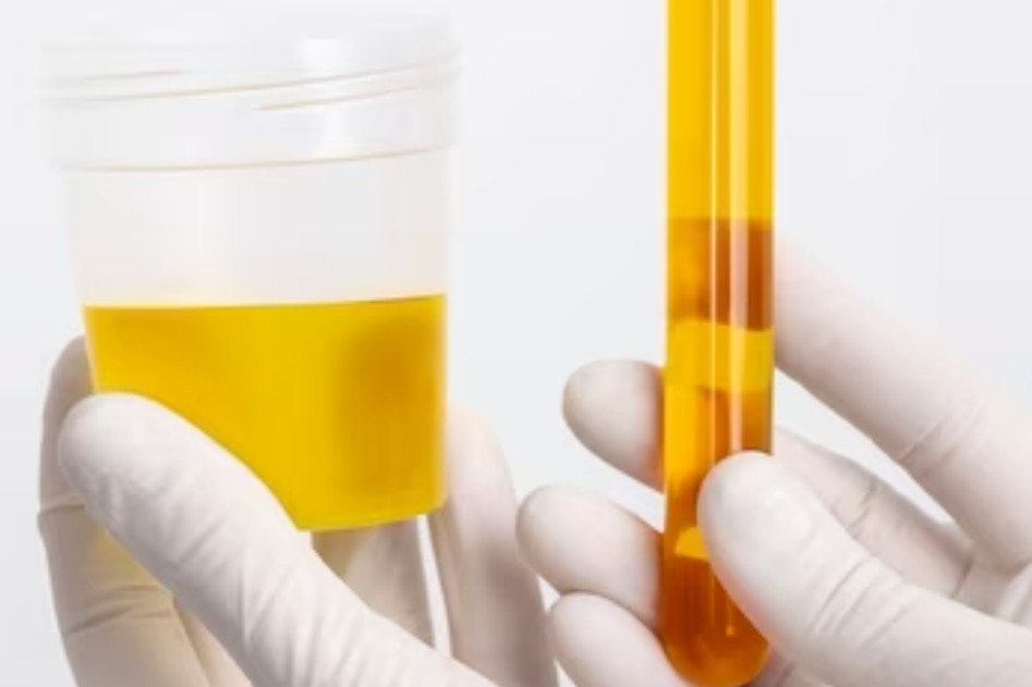 Berikut 5 Ciri-ciri Urine Sehat yang Menandakan Kalau Ginjal dalam Kondisi Baik-baik Saja
