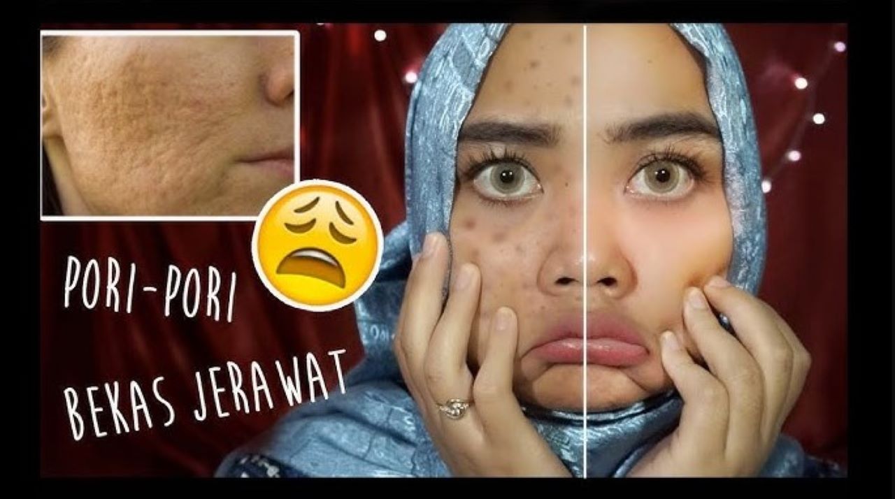 4 Merk Masker Wajah untuk Kulit Berminyak, Bisa Bantu Mengurangi Risiko Jerawat