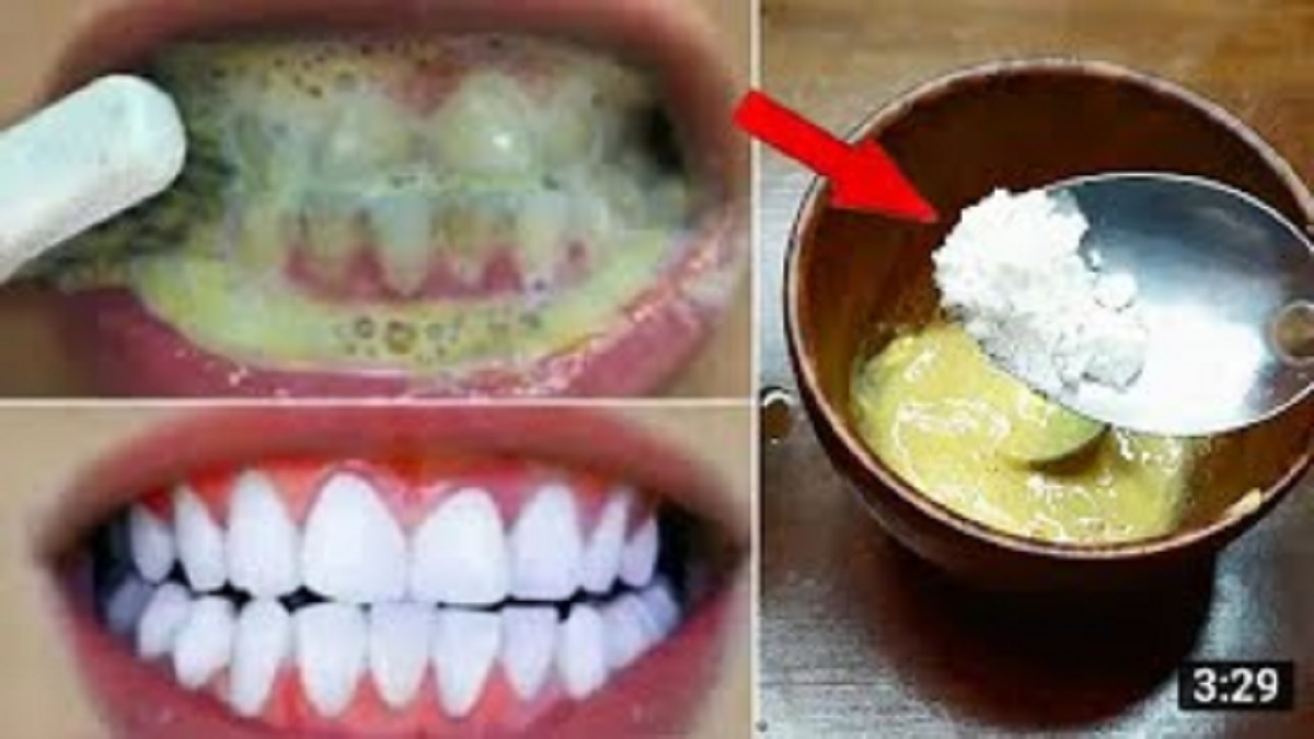 5 Cara Gampang Memutihkan Gigi dengan Bahan Alami Rumahan, Efektif Bersihkan Plak Hingga Rontokkan Karang Gigi
