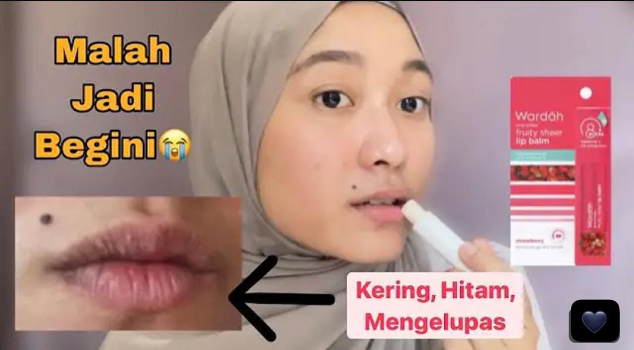 3 Lip Balm yang Mengandung SPF untuk Mencerahkan Bibir Gelap Terbaik 2024