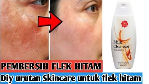 5 Rekomendasi Skincare Flek Hitam untuk Wajah Glowing, dari Pembersih Sampai Krim Malam Cepat Memutihkan!