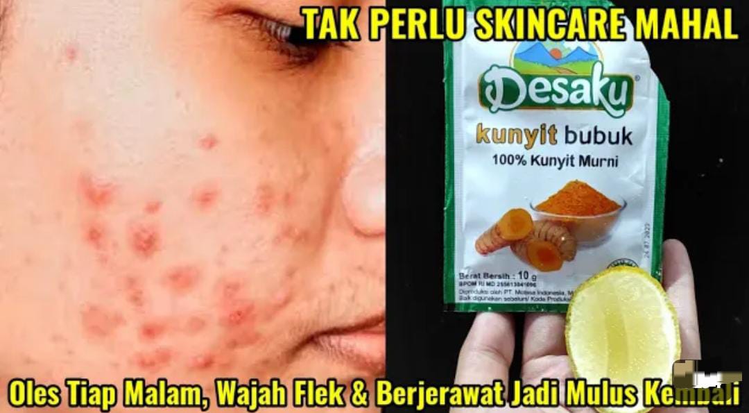 3 Cara Membuat Masker Kunyit untuk Wajah Flek Hitam dan Kendur Agar Kencang Awet Muda, Wajah jadi Mulus