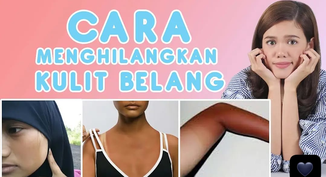 4 Cara Memutihkan Kulit Tangan yang Belang dan Gelap Cuma Pakai 2 Bahan