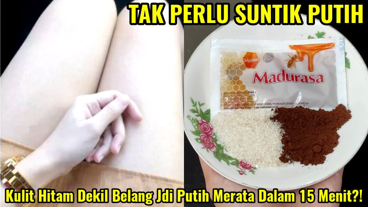 Cuma Modal Bahan Dapur, Inilah Resep Lulur Pemutih yang Ampuh Hilangkan Bekas Koreng Hitam dengan Cepat