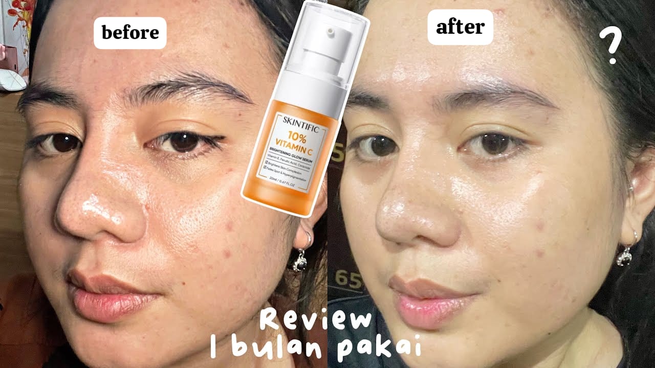 4 Serum Wajah yang Bikin Glowing dan Putih, Sudah BPOM Bikin Wajah Awet Muda Bebas Kerutan Tanpa Efek Samping