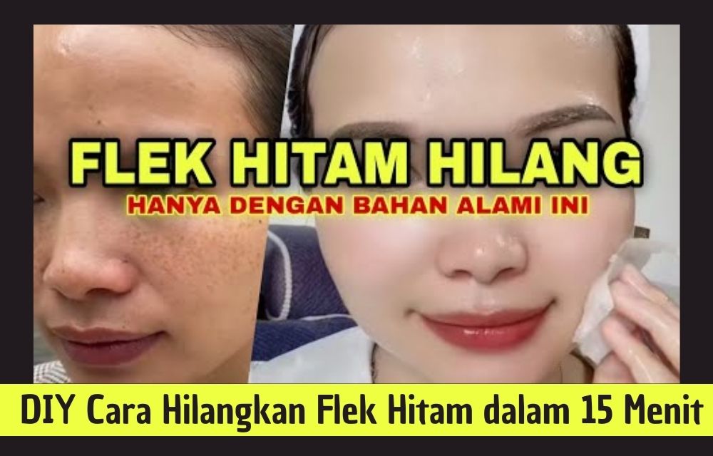 DIY Cara Hilangkan Flek Hitam dalam 15 Menit, Wajah Glowing Cukup Pakai Bahan Alami