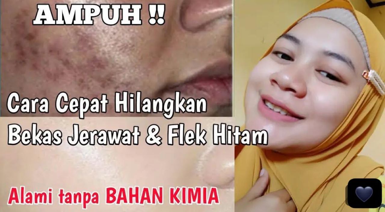 DIY Masker Pelenyap Flek Hitam Dalam 1 Malam dari Bahan Dapur, Ini 3 Cara Buatnya