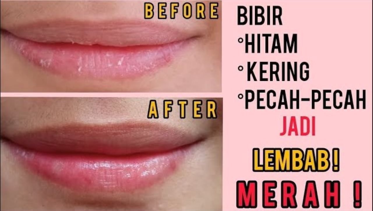 Cara Mengatasi Bibir Kering dan Pecah-Pecah Saat Puasa, Gunakan 2 Bahan Ini Bikin Merona Sekaligus 