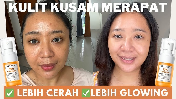 4 Serum Skintific untuk Kulit Kusam dan Flek Hitam, Rahasia Wajah Cerah Bebas Kerutan Seketika