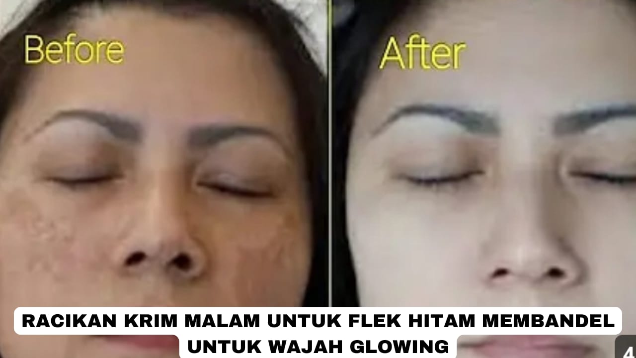 2 Racikan Krim Malam untuk Flek Hitam Membandel, Sekali Oles Kulit Langsung Glowing dan Bebas Kerutan!