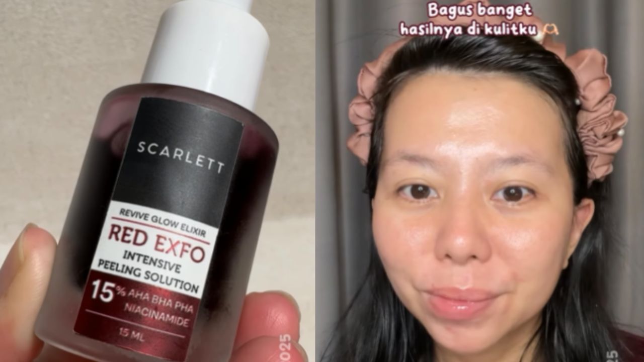 Review Jujur Peeling Solution Scarlett: Eksfoliasi Persentase Tinggi, Rasanya Agak Cekat Cekit tapi..