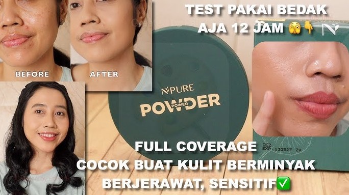 4 Bedak Kulit Berjerawat Terbaik, Tahan Minyak Seharian Nggak Bikin Acne Makin Parah