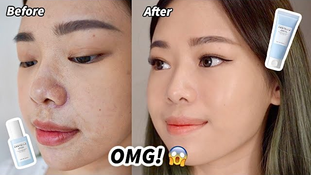 4 Rekomendasi Skincare untuk Kulit Kering dan Kusam ala Molita Lin, Rahasia Awet Muda di Usia 30 Tahun