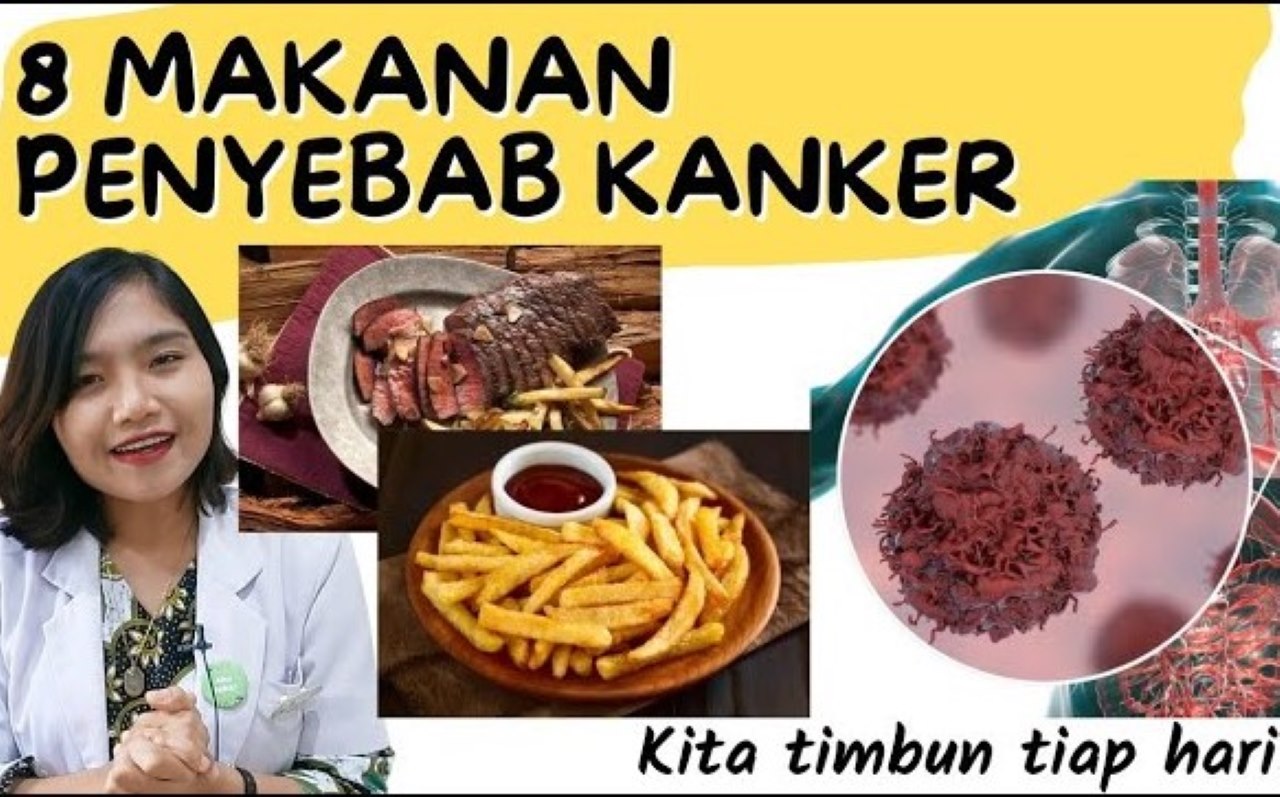 Malas Berolahraga Bisa Merupakan Hal Sepele yang Bisa Menyebabkan Kanker Lho, Cek Faktanya di Sini!