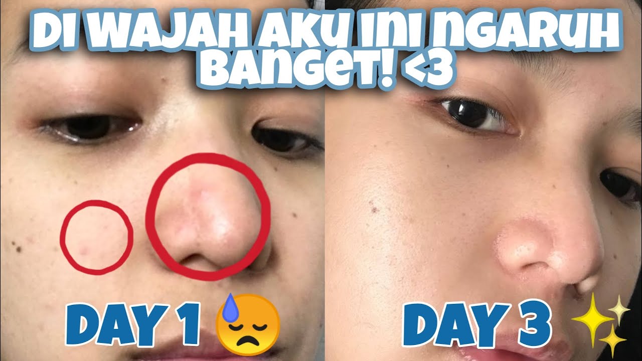 Trik Mengecilkan Pori-Pori Wajah Agar Tidak Tersumbat Pakai 1 Bahan Dapur, Wajah Langsung Glowing!