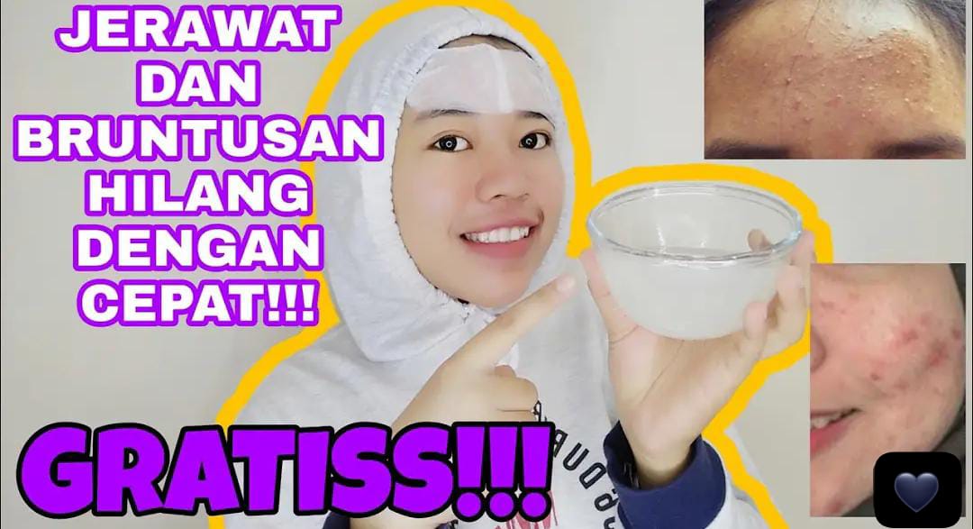 4 Langkah Menghilangkan Bruntusan di Wajah Secara Alami Agar Glowing