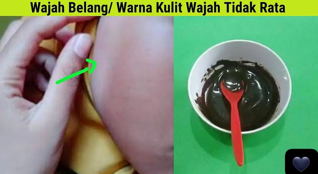 4 Cara Mengatasi Kulit Belang di Wajah dan Kusam Pakai Bahan Dapur