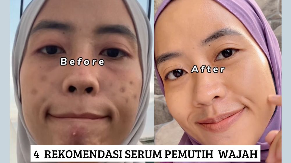 4 Rekomendasi Serum Pemutih Wajah, Cocok untuk Kulit Kusam Penuh Flek Hitam Agar Glowing Merata