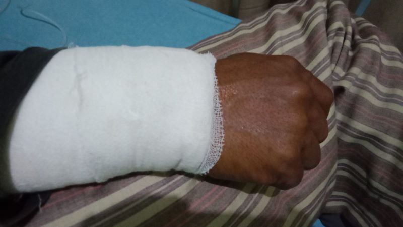 Petugas Damkar Digigit Ular Sanca, Jalani Operasi di RSUD Kajen