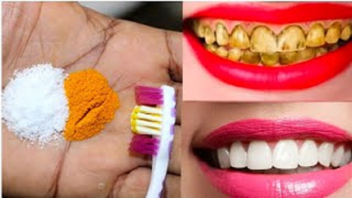 8 Penyebab Gigi Bisa Berubah Warna Kuning Hingga Menghitam, Begini Cara Mengatasinya Agar Gigi Putih Lagi
