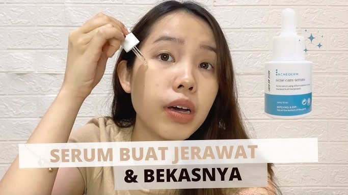 4 Rekomendasi Serum untuk Kulit Berjerawat, Redakan dan Pudarkan Bekas Noda Hitam Sekaligus