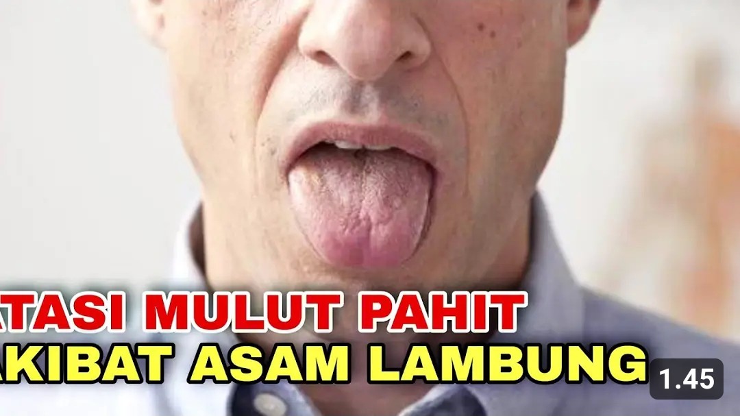 Tips Sederhana Atasi Mulut yang Pahit Karena Asam Lambung Naik ke Kerongkongan