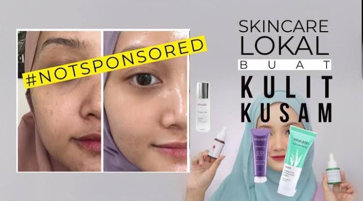 4 Skincare Lokal untuk Kulit Kering dan Kusam, Harga Terjangkau Bikn Wajah Glowing Maksimal