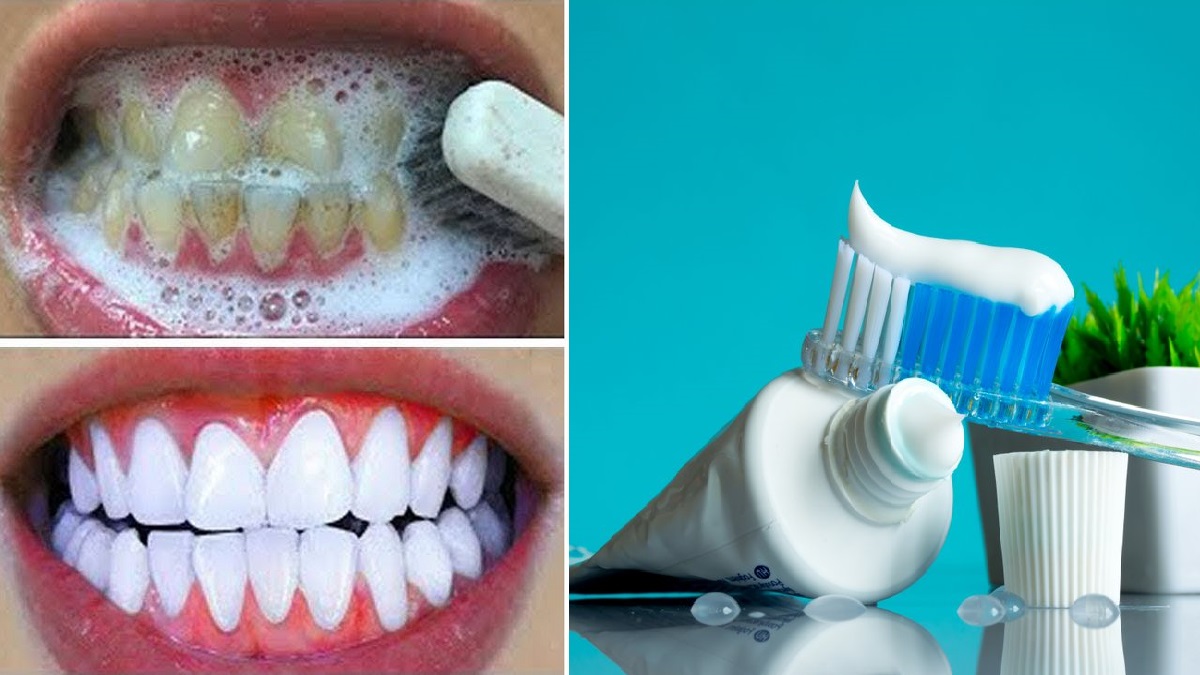 4 Produk Pasta Gigi yang Ampuh untuk Memutihkan gigi Secara Permanen, Bersihkan Plak dan Rontokan Karang  Gigi