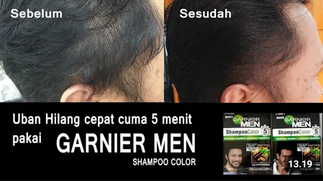 Inilah 4 Shampo untuk Menghilangkan Uban, Ada di Warung Terdekat! Mulai Seribu Rupiah Efektif Hitamkan Rambut