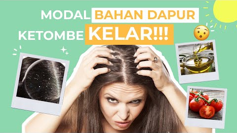 Inilah Cara Menghilangkan Ketombe dalam 1 Hari, Cukup Modal Bahan Dapur Bikin Rambut Sehat Bebas Gatal