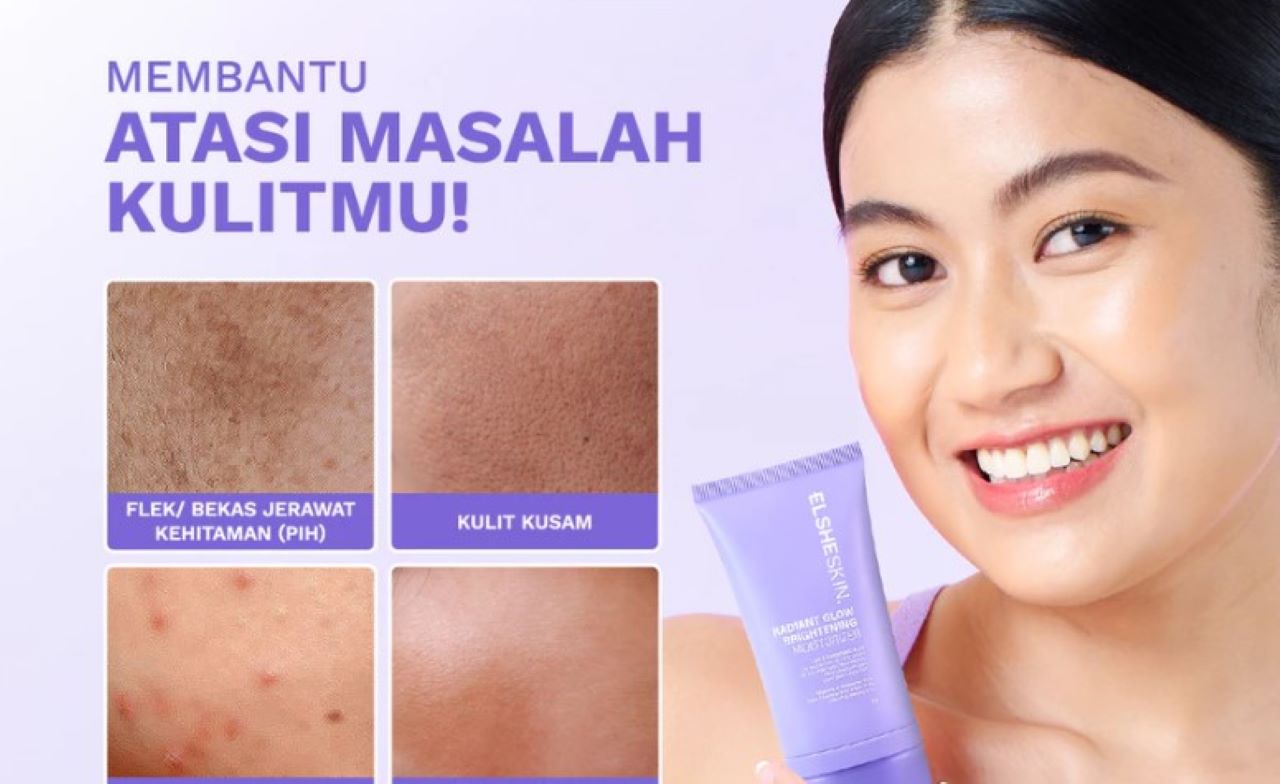 Review Elsheskin Radiant Glow Moisturizer yang Cocok untuk Kulit Kusam dan Tekstur Tidak Merata
