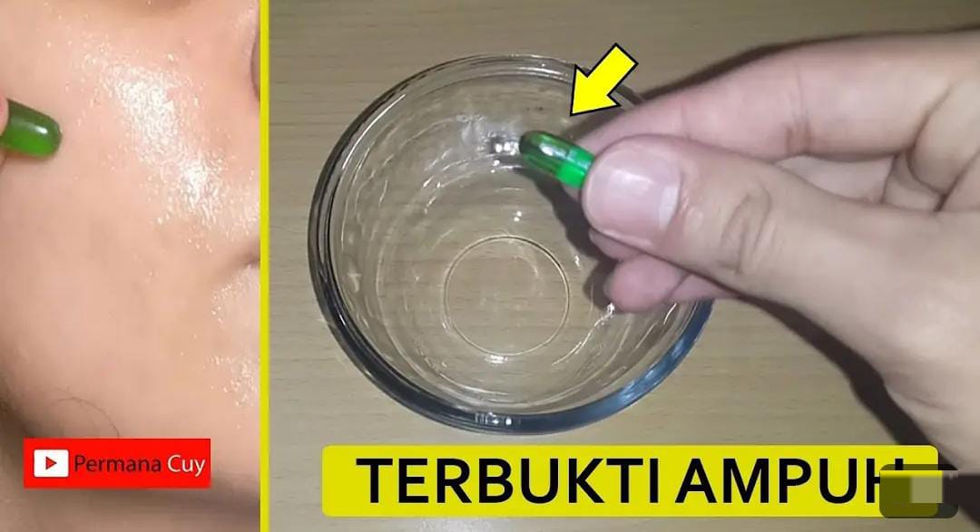 4 Vitamin untuk Menghilangkan Flek Hitam dari Dalam Tubuh, Bonus Kulit jadi Sehat dan Cerah Merata