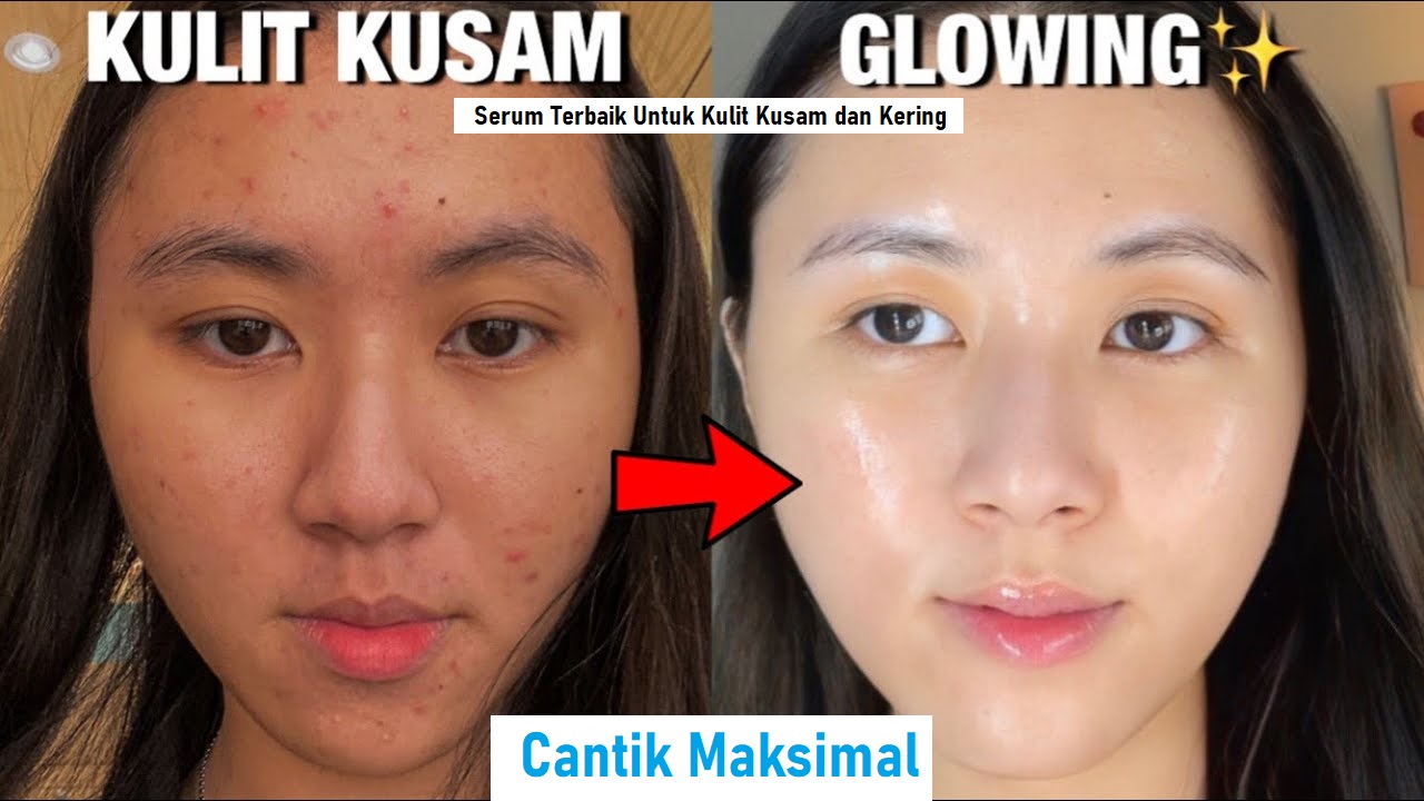 3 Serum untuk Mencerahkan Wajah Kusam dan Kering, Rahasia Kulit Glowing Bebas Kerutan dan Flek Hitam