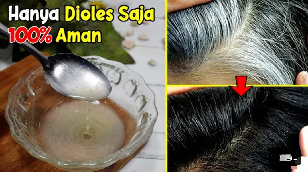 4 Cara Instan Menghilangkan Uban dengan Minyak Kayu Putih yang Benar, Sekali Usap Bikin Rambut Hitam Permanen