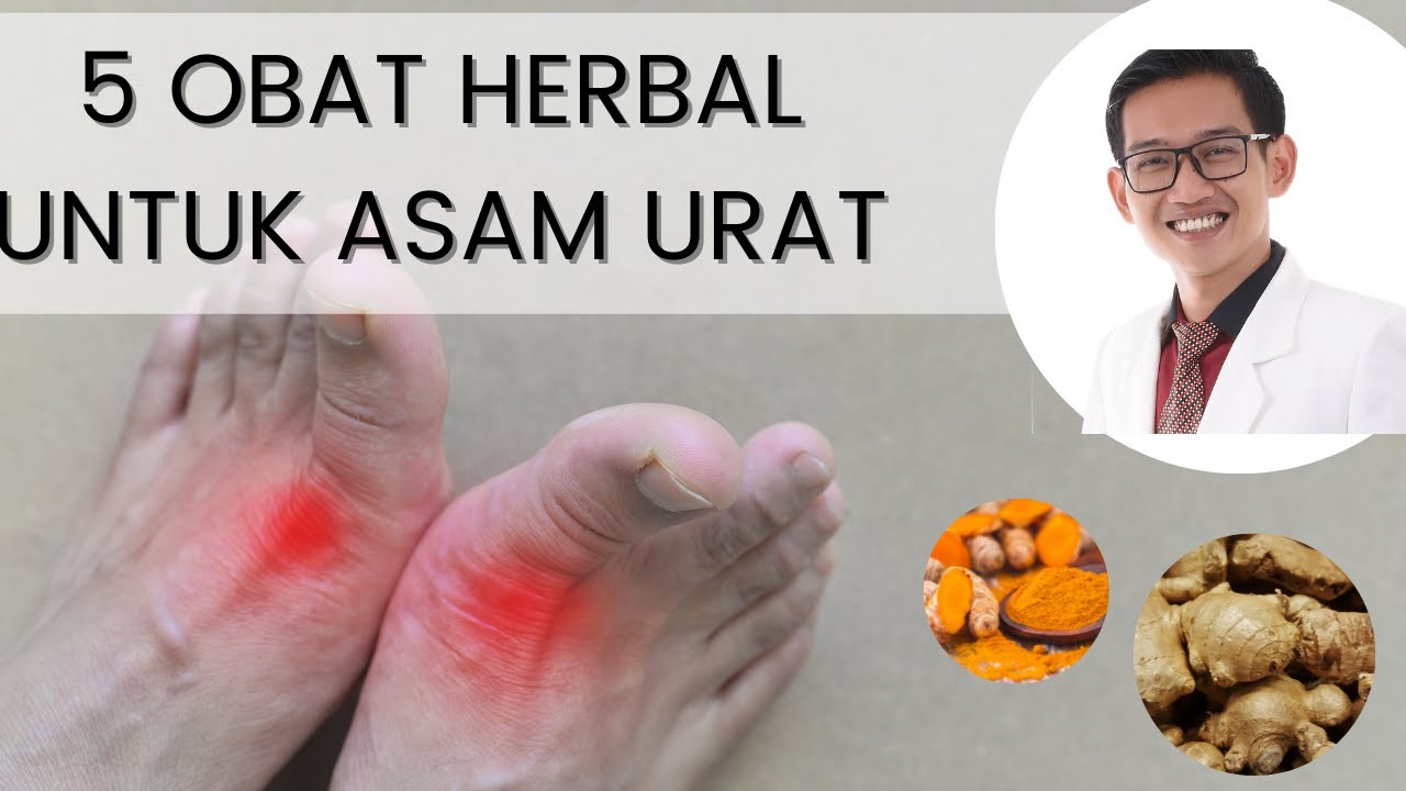 5 Obat Alami Asam Urat di Tangan dan Kaki, Ampuh Hilangkan Nyeri Sendi dengan Cepat Terutama untuk Lansia