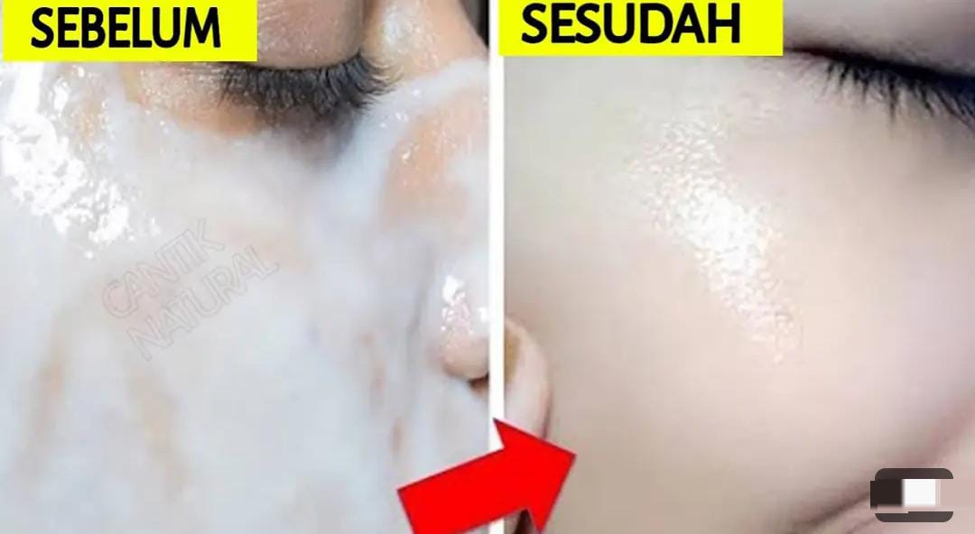 3 Cara Glowing Cepat Dengan Bahan Dapur, Bikin Wajah jadi Putih dan Kencang Awet Muda Hanya Dalam 1 Malam