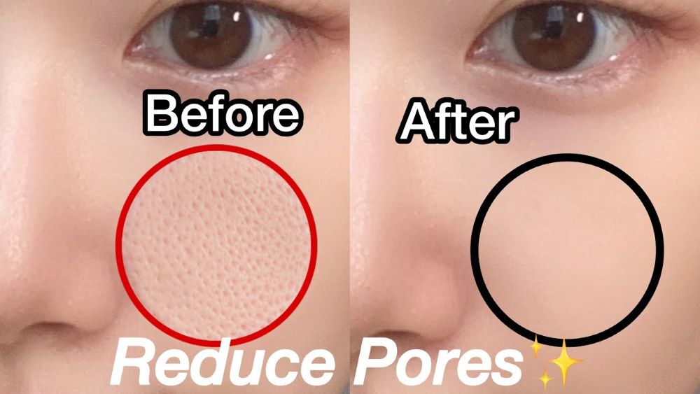 5 Skincare Korea yang Ampuh untuk Mengecilkan Pori-pori dan Bisa Bikin Wajah jadi Lebih Glowing dan Lembap