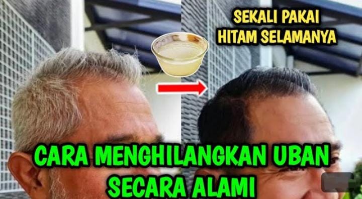 3 Bahan Dapur untuk Mengatasi Uban, Rambut Putih Jadi Hitam Permanen Sampai ke Akar Dalam Sekali Usap