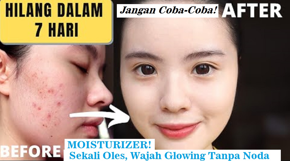 Moisturizer untuk Kulit Berminyak dan Berjerawat Mengandung SPF 15, Bikin Wajah Glowing Tanpa Noda Membandel