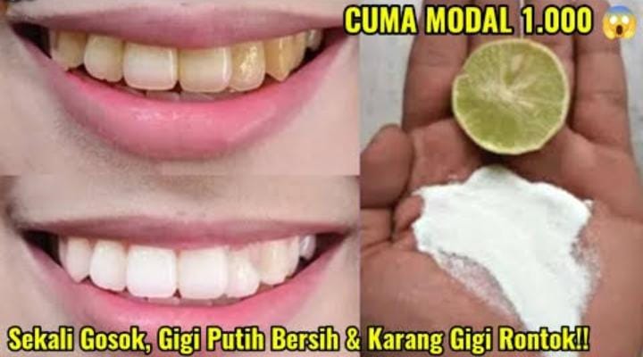 Cara Putihkan Gigi Kuning dan Berkerak Pakai Tambahan 1 Jenis Daun, Rahasia Bebas Bau Mulut dan Plak 