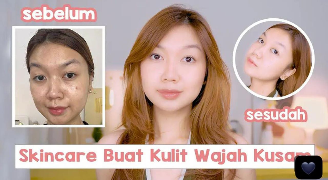 4 Rekomendasi Serum Vitamin C Termurah! Fokus Mencerahkan kulit hingga Mengatasi Noda Hitam 