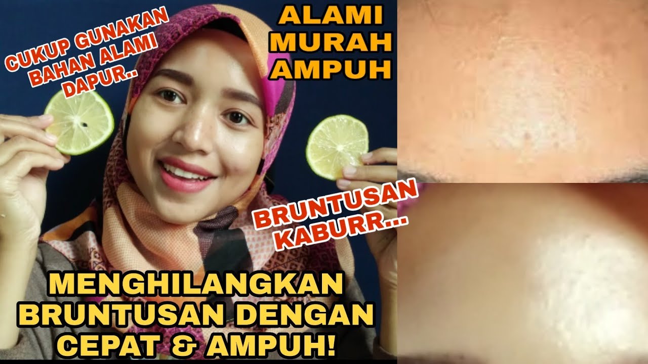 5 Cara Pakai Jeruk Nipis untuk Wajah Bruntusan, Hasil Maksimal Modal Minimal!